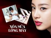 Làm đẹp - Cách xử lý khi lông mày trở thành "thảm họa" sau thẩm mỹ