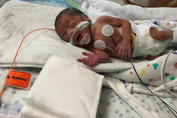 Sức sống mạnh mẽ của bé sinh non 23 tuần, chỉ nặng 7 lạng - 3