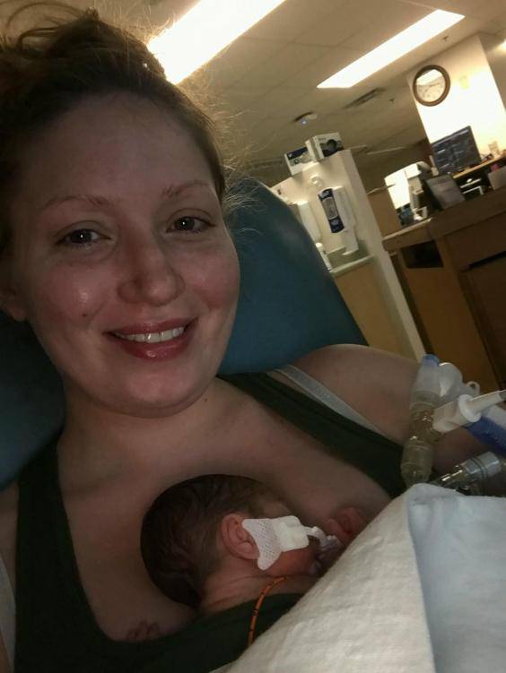 Sức sống mạnh mẽ của bé sinh non 23 tuần, chỉ nặng 7 lạng - 2