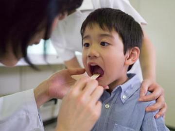 Viêm họng cấp ở trẻ: Triệu chứng và cách điều trị tại nhà
