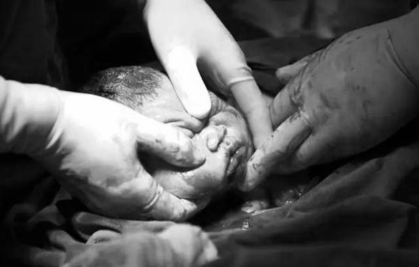 Thai 38 tuần đã mổ đẻ được chưa? - 1