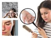 Làm đẹp - Tóc rụng nhiều không chỉ mất thẩm mỹ mà còn mách bạn về tình trạng sức khỏe