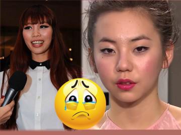 Mụn hoành hành... mãi không tha, nguyên nhân do đâu?