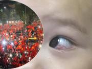 Làm mẹ - Bố mẹ “đi bão” cổ vũ U23 Việt Nam, con 16 tháng bị cán cờ quẹt chảy máu tròng mắt