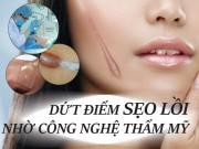Làm đẹp - Sẹo lồi lâu năm và 3 "vị cứu tinh" từ các công nghệ thẩm mỹ hiện đại