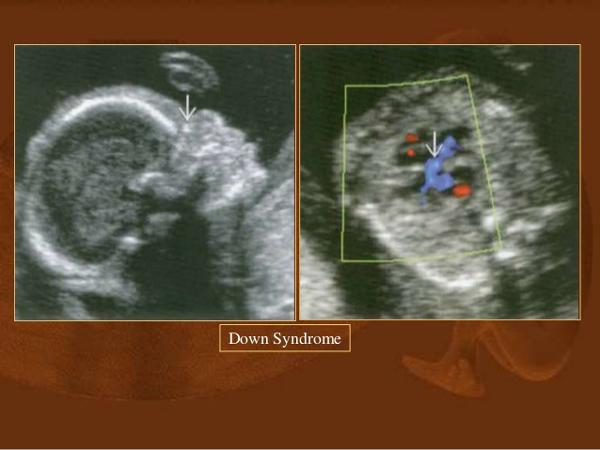 Không chỉ chiều dài, cân nặng, chiều dài xương mũi thai nhi theo tuần mẹ cũng cần quan tâm - 2