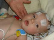 Sức khỏe - Cảnh báo trẻ sơ sinh xuất huyết não do thiếu vitamin K