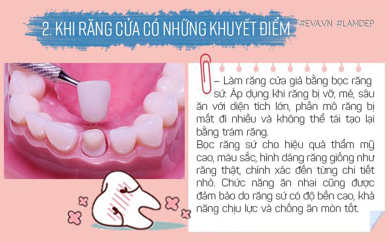 Áp dụng khi răng bị vỡ, mẻ, sâu ăn với diện tích lớn, phần mô răng bị mất đi nhiều.
