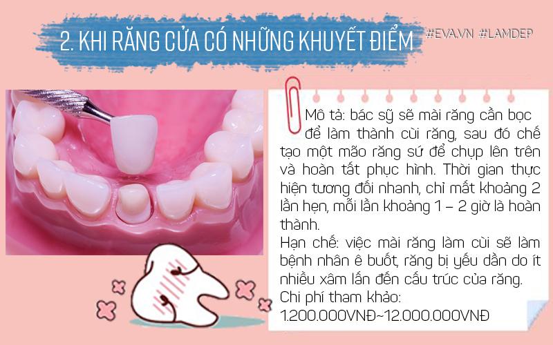 Thời gian thực hiện tương đối nhanh, 2 lần hẹn với mỗi lần khoảng 1-2 tiếng.
