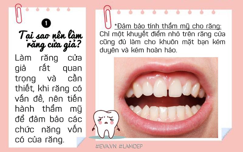 Răng cửa là nhóm răng phía trước, là răng đóng vai trò thẩm mỹ chủ chốt cho toàn hàm răng.
