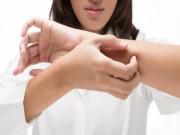 Sức khỏe - Điều trị chứng ngứa da mùa lạnh