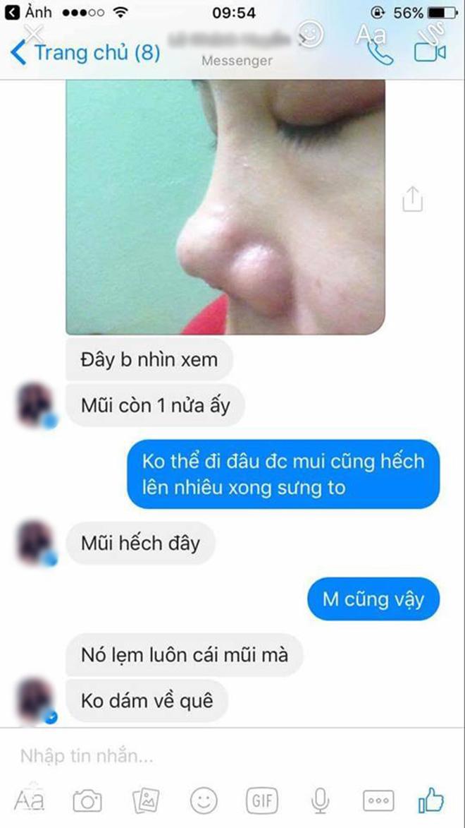 Bỏ 25 triệu làm mũi và bị hỏng, cô gái phải chịu 9 lần khâu lại không thuốc tê! - 7