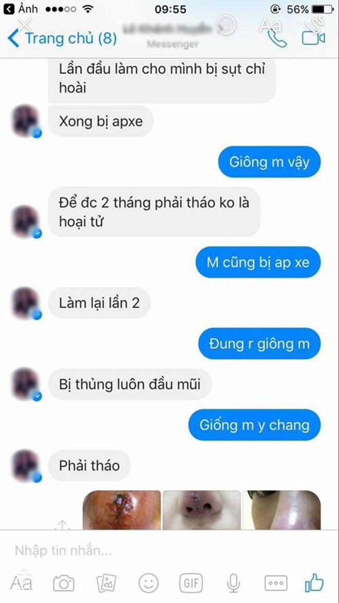 Bỏ 25 triệu làm mũi và bị hỏng, cô gái phải chịu 9 lần khâu lại không thuốc tê! - 8