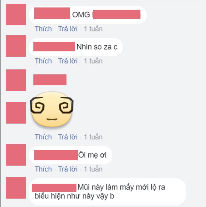 Bỏ 25 triệu làm mũi và bị hỏng, cô gái phải chịu 9 lần khâu lại không thuốc tê! - 6