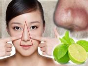 Làm đẹp - Đẩy lùi nguy hiểm tiềm ẩn từ mụn bọc trên mũi bằng những nguyên liệu này!