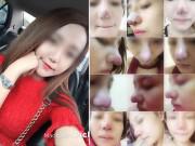 Đẹp - Bỏ 25 triệu làm mũi và bị hỏng, cô gái phải chịu 9 lần khâu lại không thuốc tê!