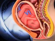Bà bầu - Muốn sinh con không bị dị tật, đây là 5 việc mẹ không được làm!