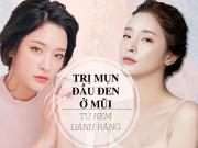 Làm đẹp - Trị mụn đầu đen ở mũi với công thức chưa đến 30 ngàn đồng từ kem đánh răng