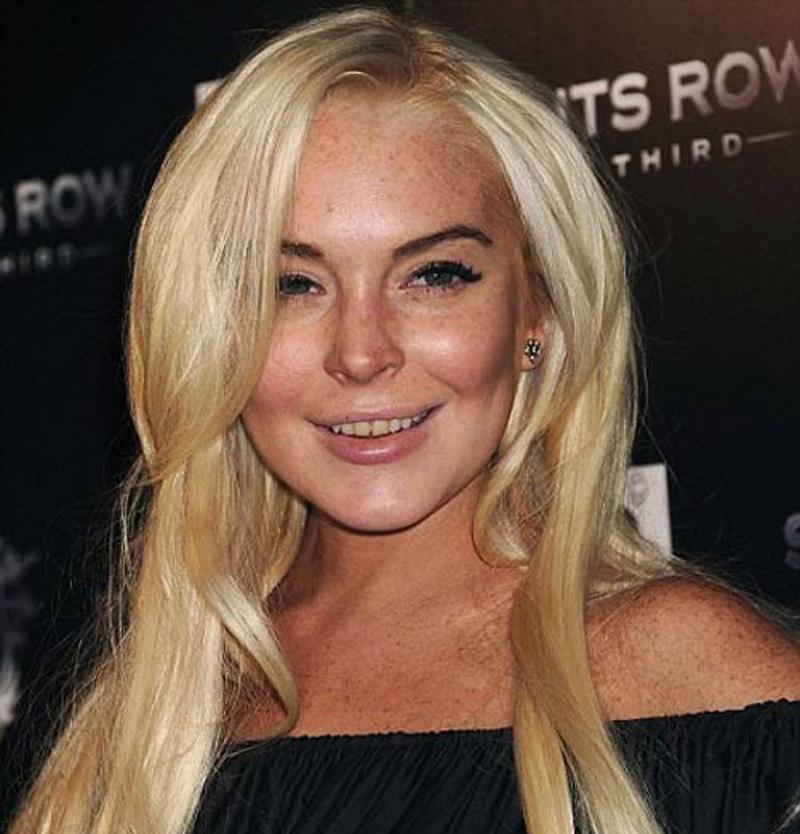 Lindsay Lohan luôn bị chê bai bởi hàm răng không đẹp.
