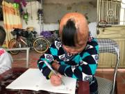 Nuôi con - Cuộc sống đầy nghị lực của cậu bé “đuốc sống”