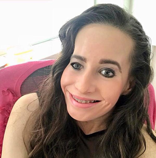 Sinh ra với nửa khuôn mặt amp;#34;kỳ dịamp;#34;, người phụ nữ sau 30 năm mới có thể nghe và nhai - 2