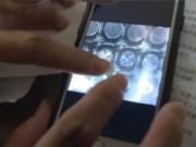 Bà bầu - Mẹ vừa nằm lên bàn đẻ đã sinh, bác sĩ không kịp đỡ khiến bé bị thương nặng