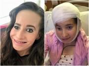 Sức khỏe - Sinh ra với nửa khuôn mặt "kỳ dị", người phụ nữ sau 30 năm mới có thể nghe và nhai