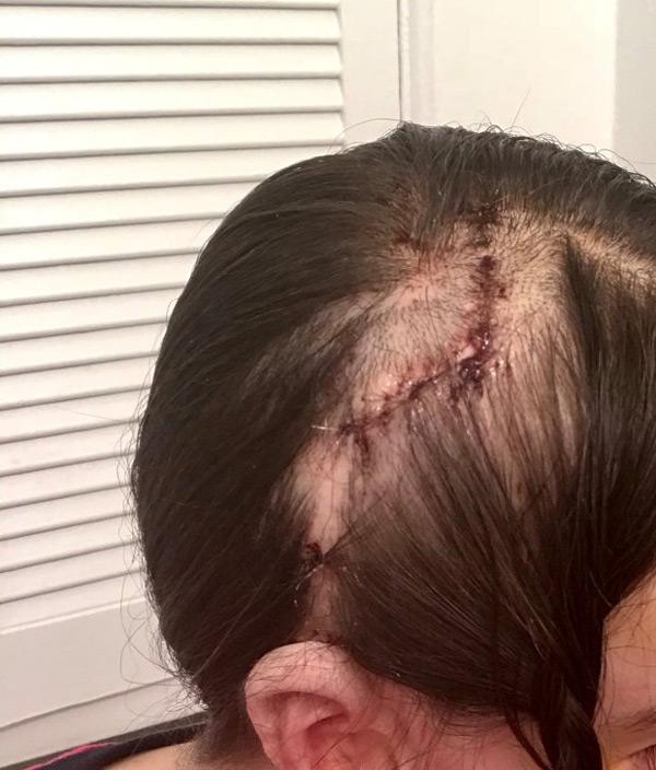 Sinh ra với nửa khuôn mặt amp;#34;kỳ dịamp;#34;, người phụ nữ sau 30 năm mới có thể nghe và nhai - 4