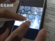 Tin tức - Thai phụ vừa nằm xuống đã sinh, bác sĩ đỡ chậm khiến em bé rơi xuống chấn thương nghiêm trọng