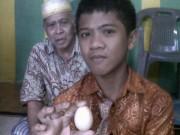 Sức khỏe - Kỳ lạ cậu bé 12 tuổi một tuần... đẻ ra 7 quả trứng