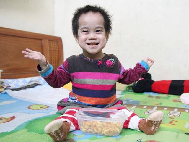 Cuộc sống mới của bé gái đi bằng 