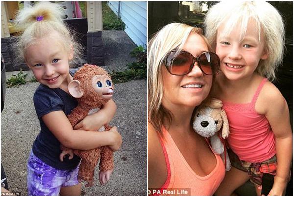 Bé gái 6 tuổi có mái tóc amp;#34;bất trịamp;#34; như thiên tài Einstein vì mắc hội chứng cực hiếm - 3