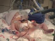 Bà bầu - Siêu âm thai 20 tuần, bố mẹ đau đớn khi thấy con có tim, gan, ruột nằm ngoài cơ thể