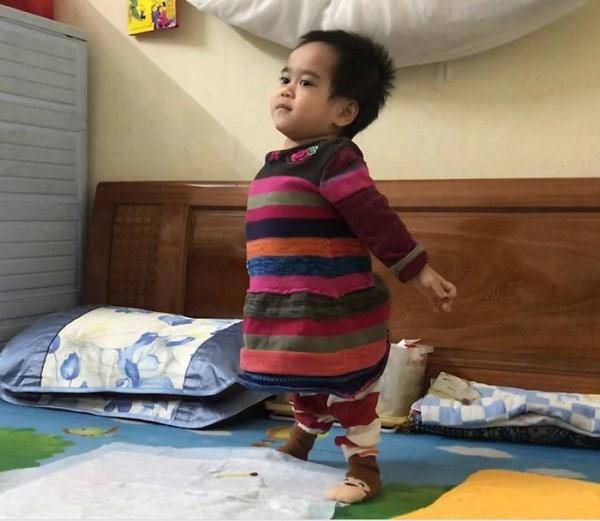 Tin tức 24h: Em bé đi bằng “4 chân”, sống nhờ bao cao su, băng vệ sinh giờ ra sao? - 1