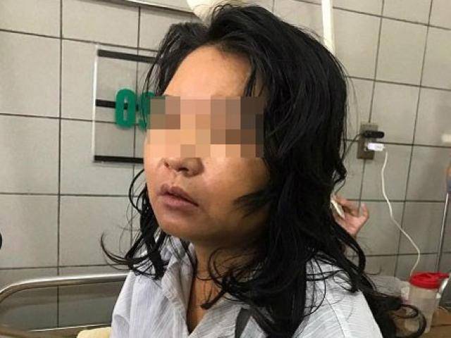 Người phụ nữ bị suy gan nghi do uống thực phẩm chức năng giảm cân đã tử vong
