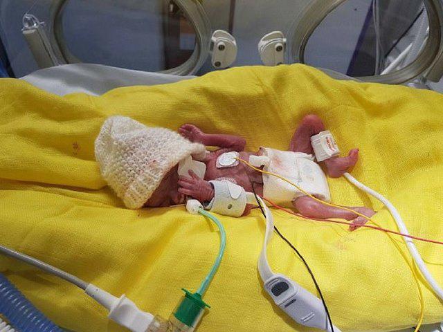 Nhật kí xúc động về cuộc chiến dũng cảm của bé trai sinh non 3 tháng, nặng 0,5kg