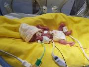 Bà bầu - Nhật kí xúc động về "cuộc chiến" dũng cảm của bé trai sinh non 3 tháng, nặng 0,5kg