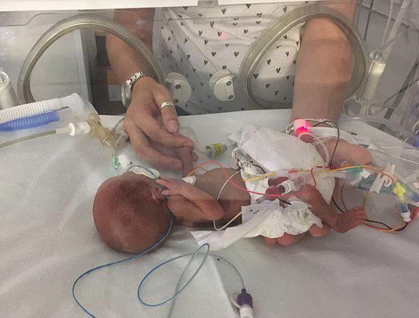 Nhật kí xúc động về amp;#34;cuộc chiếnamp;#34; dũng cảm của bé trai sinh non 3 tháng, nặng 0,5kg - 4