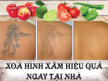 Bất ngờ với 6 nguyên liệu xóa hình xăm an toàn - hiệu quả ngay từ lần đầu tiên