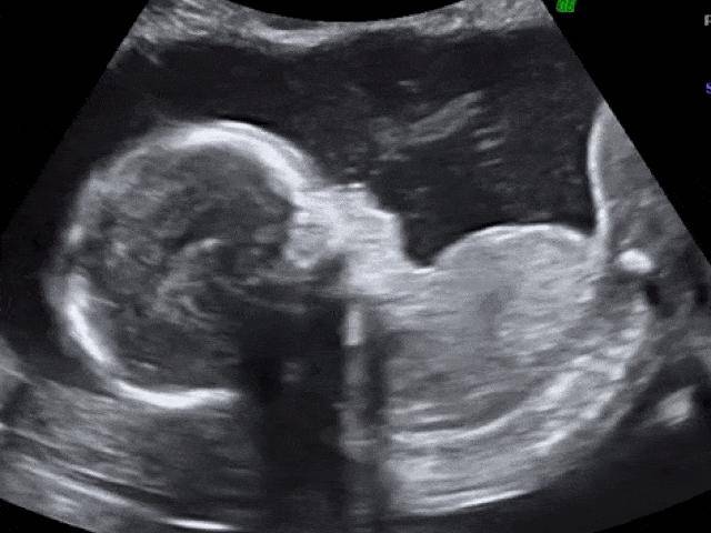 Revealing 17 wonderful things about the activities of the fetus in the mother's womb