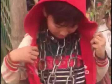 Phía sau câu chuyện bé trai bị chú ruột khóa xích sắt nhiều vòng trên cổ ở Thanh Hóa