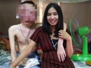 Eva Yêu - Gương mặt biến dạng đến không nhận ra, chàng trai vẫn được bạn gái yêu thương chăm sóc