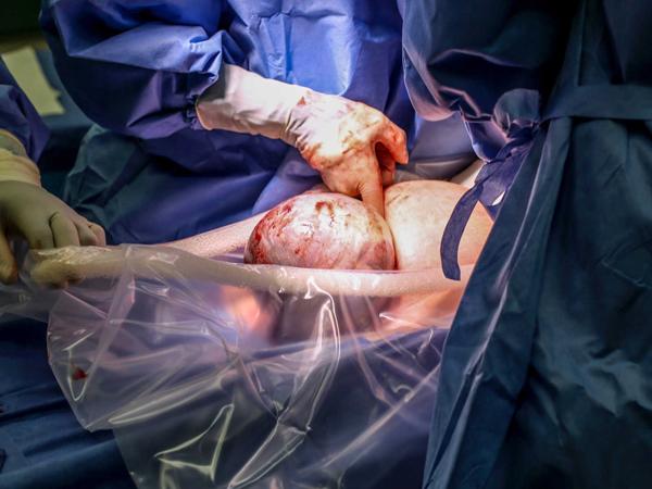 Bé gái vừa chào đời, y tá lập tức hô: amp;#34;Bố đâu! Chụp ảnh lại ngay kẻo lỡ!amp;#34; - 2