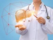 Sức khỏe - Gan nhiễm mỡ dù nhẹ cũng nguy hiểm