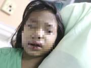 Tin tức - Đón con ở nhà chồng cũ, mẹ sốc nặng phát hiện con bị mẹ kế đánh, ép uống nước sôi