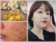 Đẹp - Bôi vitamin E lên mặt để dưỡng da, chị em nhận được kết quả hơn cả mong đợi!