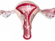 Sức khỏe - Phụ nữ cần nắm chắc kiến thức về buồng trứng đa nang nếu không muốn bị vô sinh