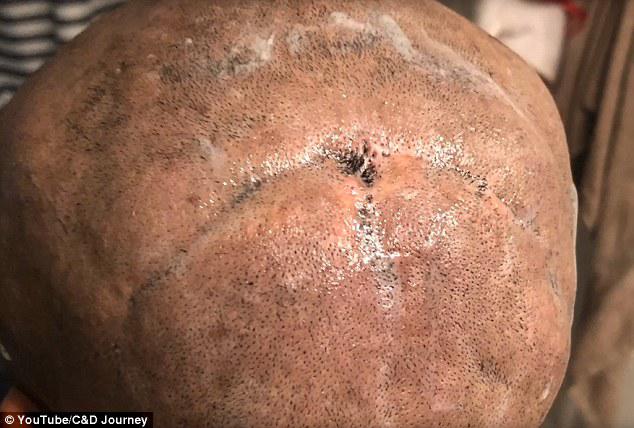 Ham rẻ khi thuê người tạo kiểu tóc, cô gái không ngờ phải cạo nguyên cả đầu - 2