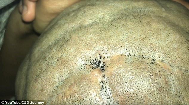 Ham rẻ khi thuê người tạo kiểu tóc, cô gái không ngờ phải cạo nguyên cả đầu - 3