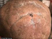 Sức khỏe - Ham rẻ khi thuê người tạo kiểu tóc, cô gái không ngờ phải cạo nguyên cả đầu